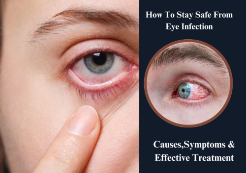 eyes infection